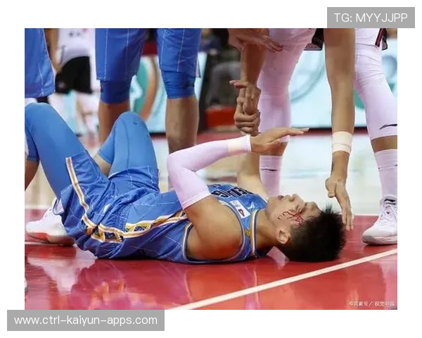 左直拳精准命中眉骨破开